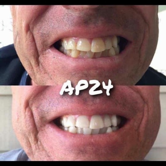 THE BEST Whitening Toothpaste!  NO HARSH CHEMICALS - Picture 10 of 12